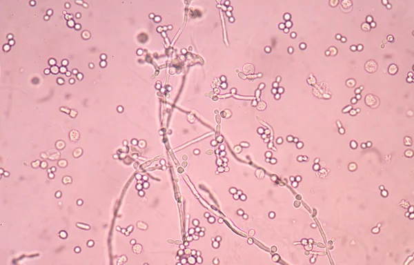 Levadura incipiente de ramificación fresca — Foto de Stock