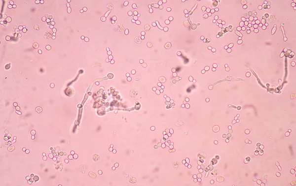 Levadura incipiente de ramificación fresca —  Fotos de Stock