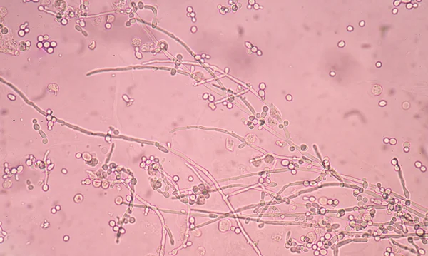 Levadura incipiente de ramificación fresca — Foto de Stock