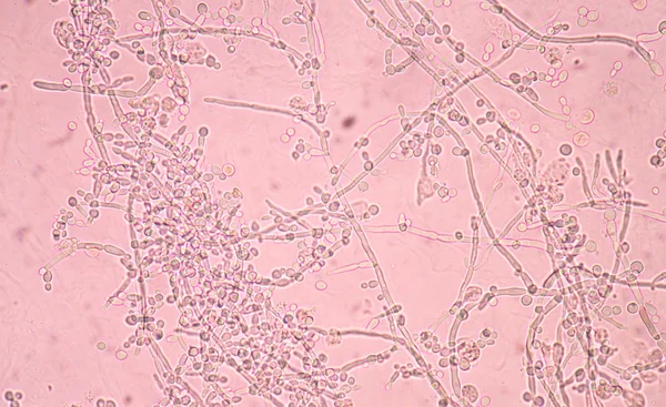 Ramificación fresca células de levadura en ciernes — Foto de Stock