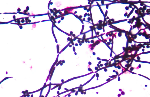 Fresco de ramificação brotamento de células de levedura — Fotografia de Stock