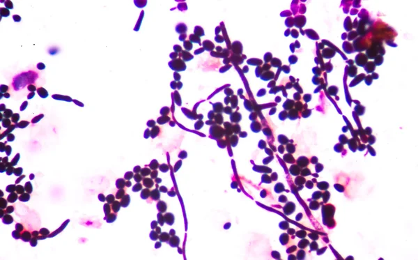 Свіжі розгалужені дріжджові клітини — стокове фото