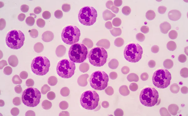 De cellen van het bloed van de neutrofiele granulocyten — Stockfoto