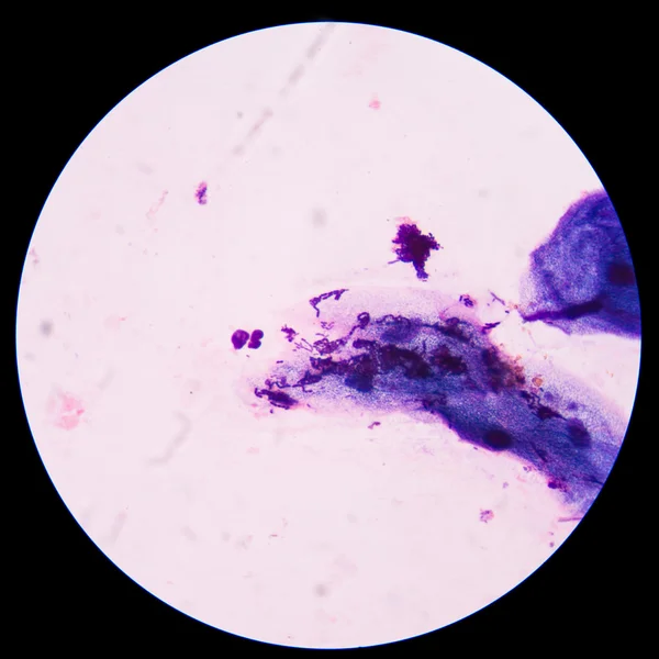 Czerwony komórek bakterii w — Zdjęcie stockowe