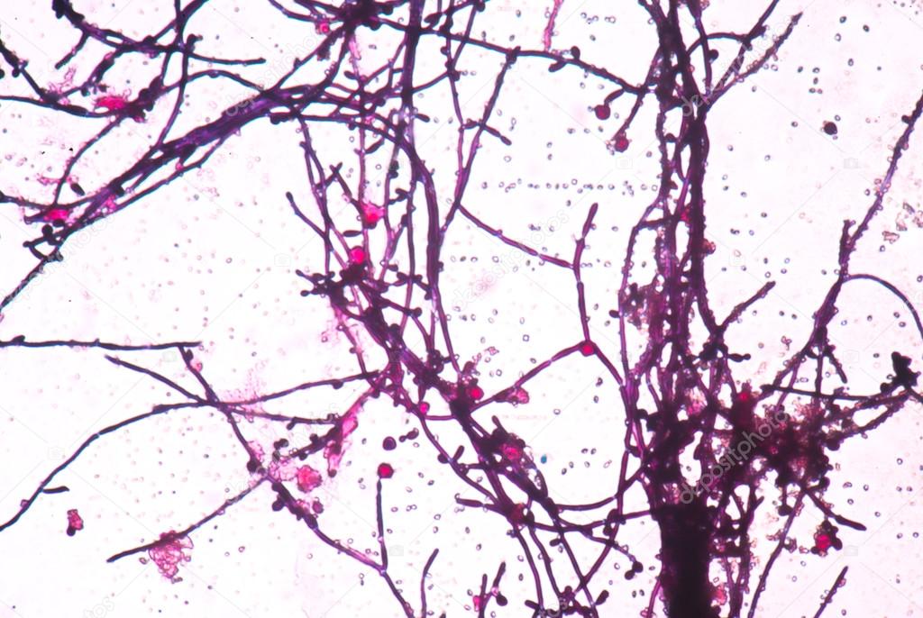 budding yeast gram stain