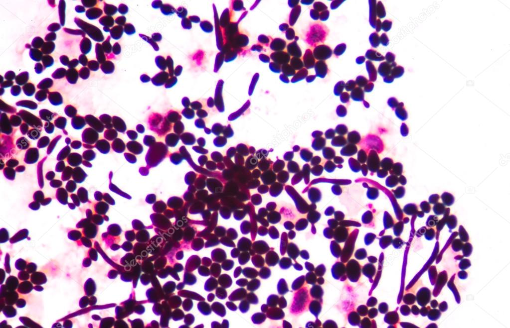 budding yeast gram stain