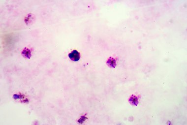 Sıtma parazit için kan Filmler.