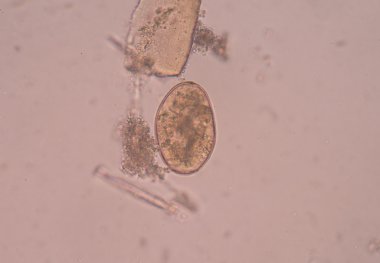 dışkıda parazit yumurta.