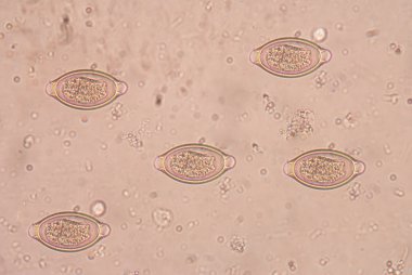 İnsan whipworm (Trichuris trichiura veya Trichocephalus trichi