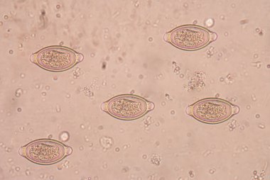 A trichocephalosis geohelminth