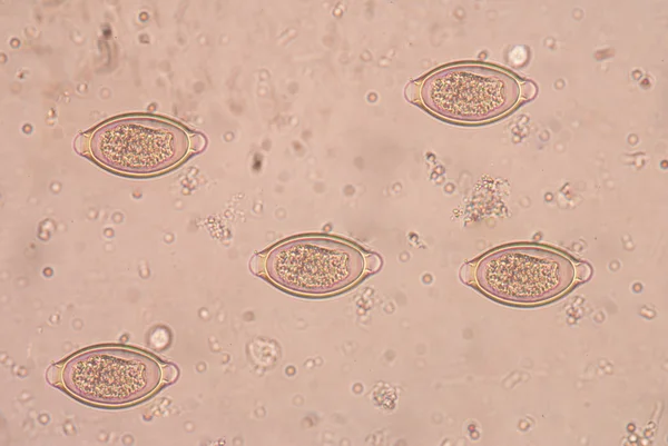 人类的鞭 （毛首鞭虫或 Trichocephalus trichi — 图库照片