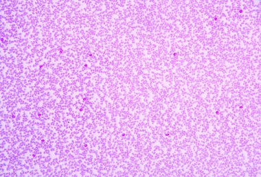  Kan yayması genellikle bir izleme testi anormal resul için kullanılır