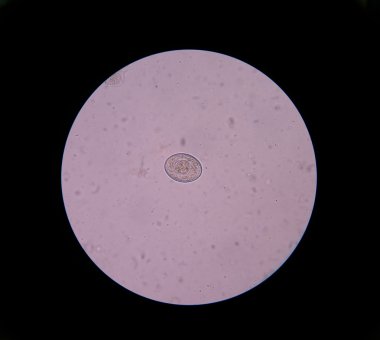 Marty Tenya (bir tür helmint cinsidir)