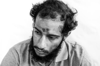 Yüzünde kömür tozu solgun Arapça