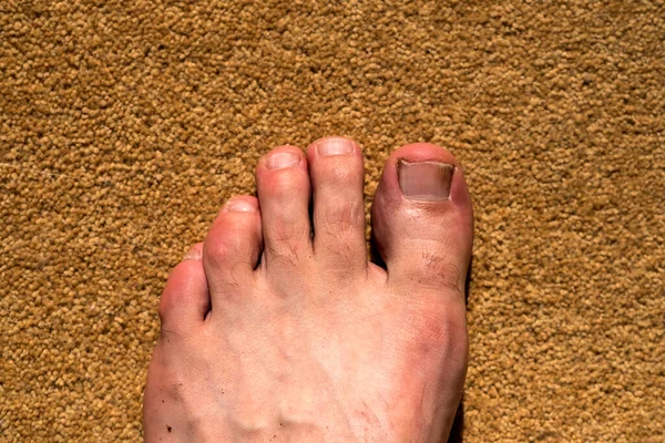 Toes Left Foot Adult White Man — Stock Photo, Image