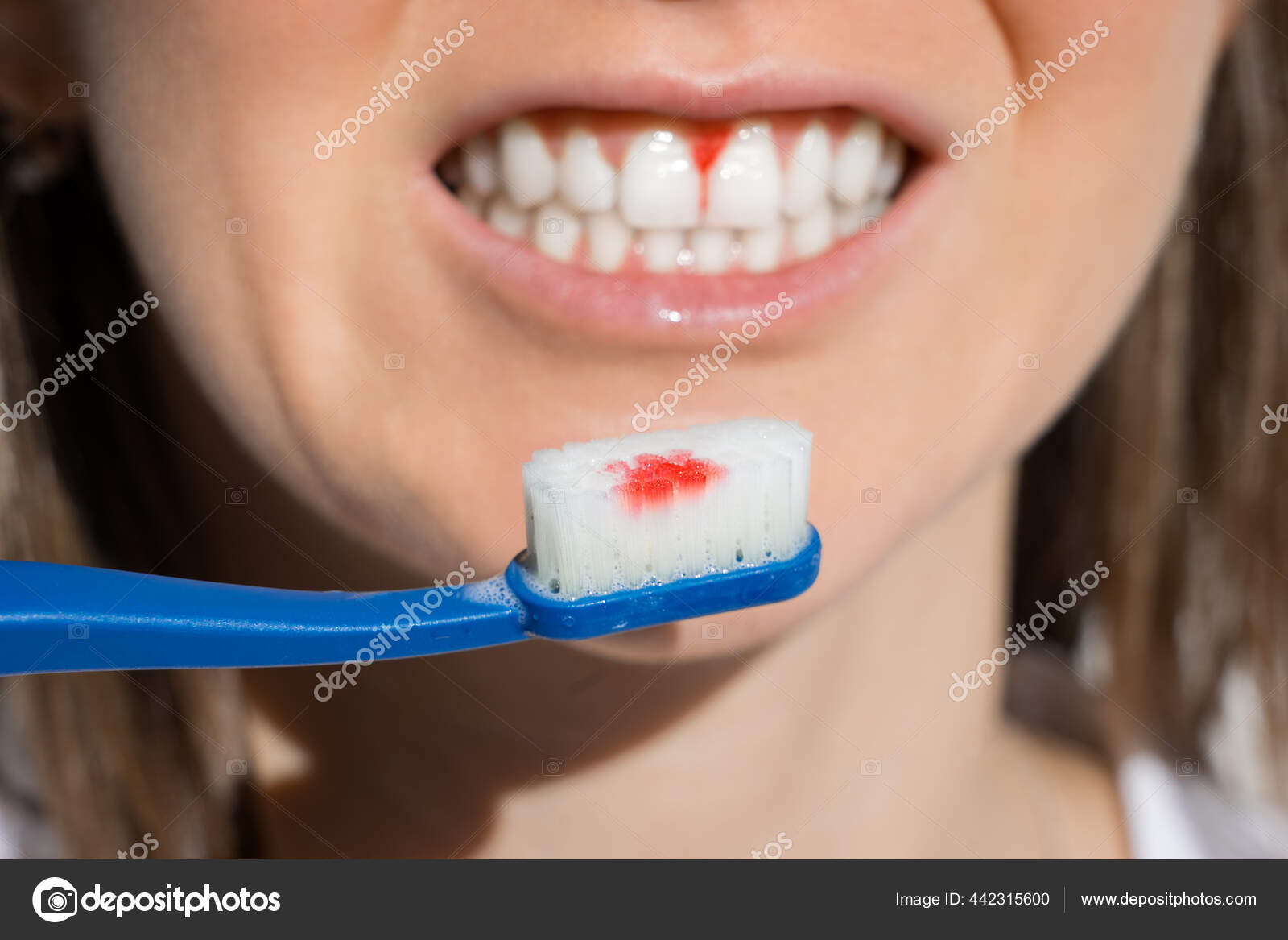 Brush your teeth boli. Почему при чистках болят зубы. Профилактика стоматологических заболеваний. Профгигиена (ультразвук + air-flow). Классификация кариес пульпит периодонтит.