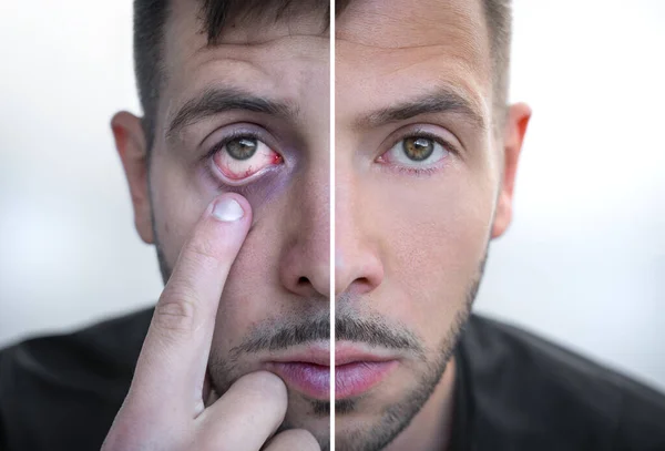 Man face divided into two parts one healthy and one unhealthy. Before and after addiction treatment. Drug or alcohol addiction concept. Recovery and rehabilitation — Stock Photo, Image