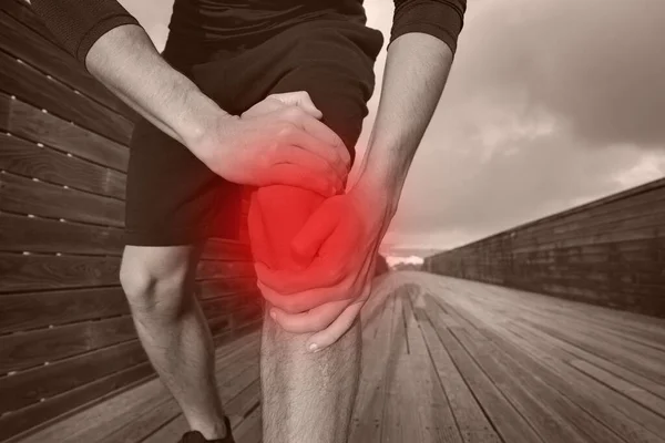 뛰는 사람은 무릎 부상과 통증으로 고통을 겪습니다. 뇌손상, 탈구 된 무릎, 테노 미티 — 스톡 사진