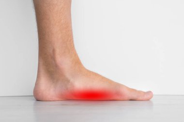 Ayakta ağrı var çünkü güçlü düz taban aynı zamanda pes planus ya da düşmüş kemer de denir. Ayaklarının içindeki kemerler düzleşmiş.