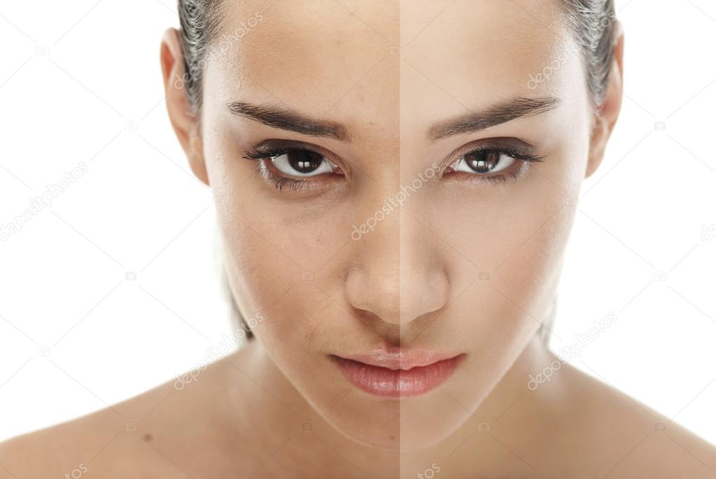 Face of beautiful young woman before and after