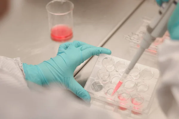 Científico Trabajando Laboratorio Mano Microbiólogo Con Guantes Sosteniendo Una Pipeta — Foto de Stock