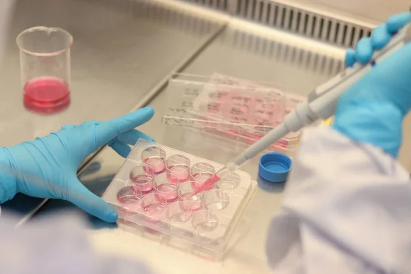 Científico Trabajando Laboratorio Mano Microbiólogo Con Guantes Sosteniendo Una Pipeta — Foto de Stock