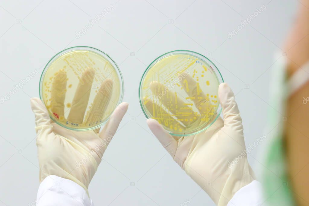 Microbiologists hand holding petri-dish with growing cultures of microorganisms, fungi and microbes. Colorful fluid in glass ware plate tower, Biotechnology scientist working in lab.