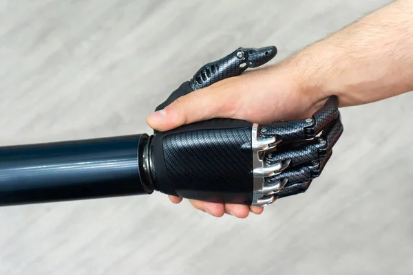 Bionic arm. Modern prosthetic limbs. High strength carbon fiber products.