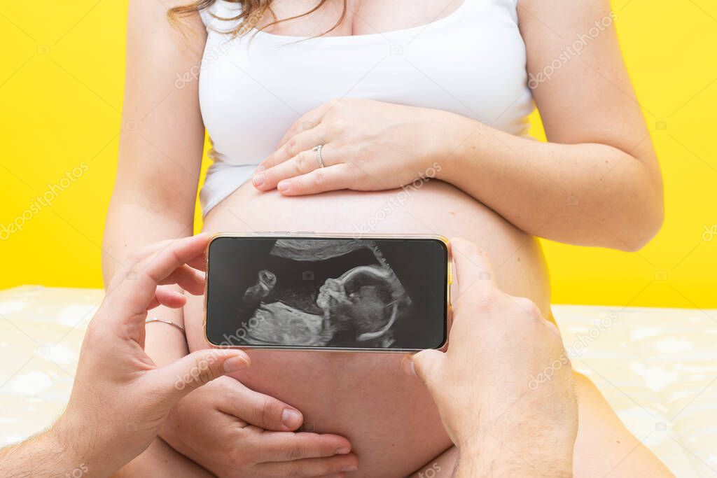 Ultrasound of a baby on a mobile phone screen in front of a pregnant woman with her hands on her belly sitting in front of a yellow background