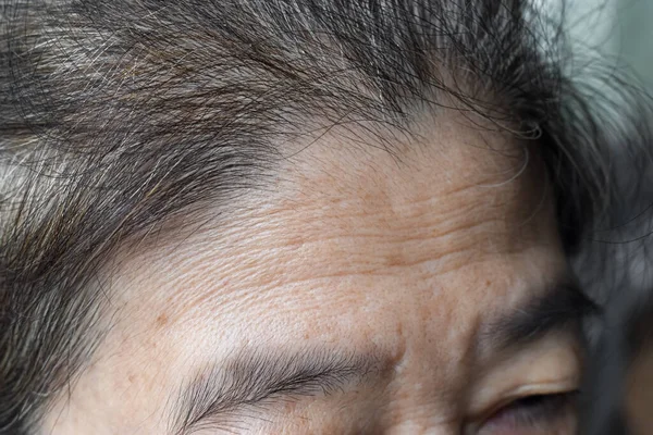 Hautfalten Oder Stirnfalten Bei Älteren Frauen Aus Südostasien Myanmar Oder — Stockfoto