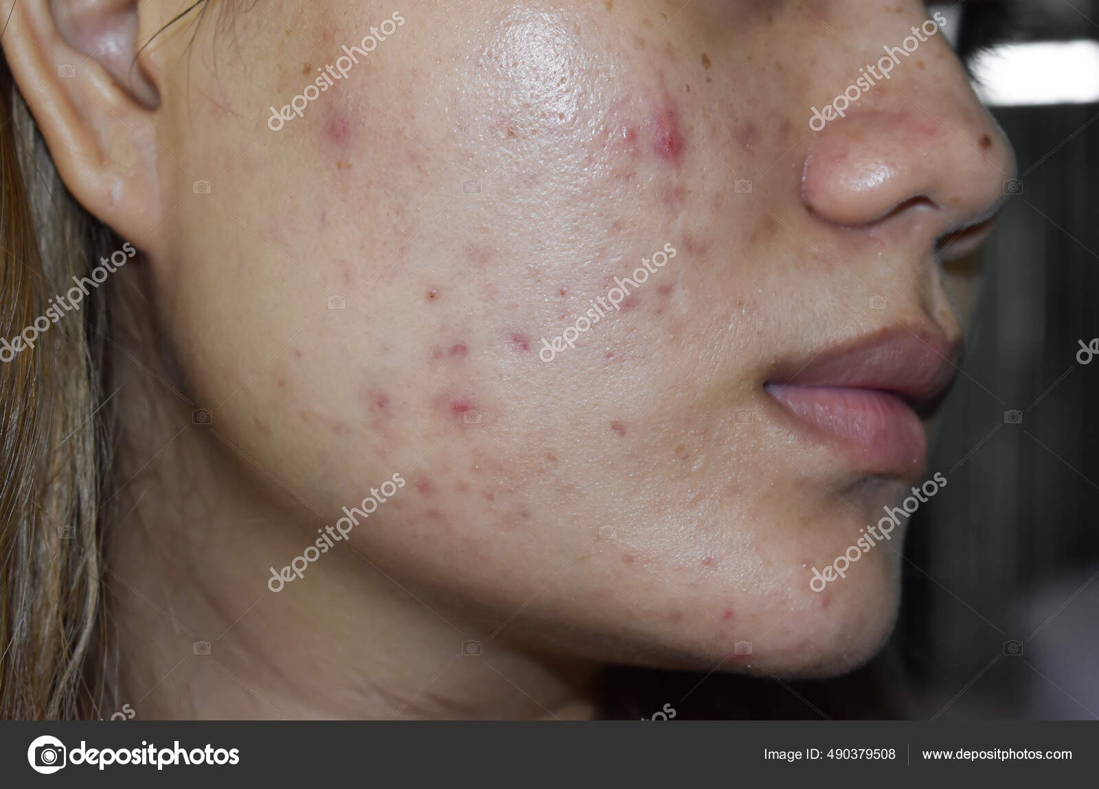 black spots