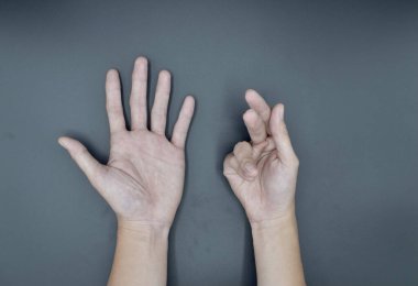 Güneydoğu Asyalı, Myanmar 'lı yaşlı kadın eli. Deri kırışıyor, deri gevşiyor ve damarlar yaşlanıyor..