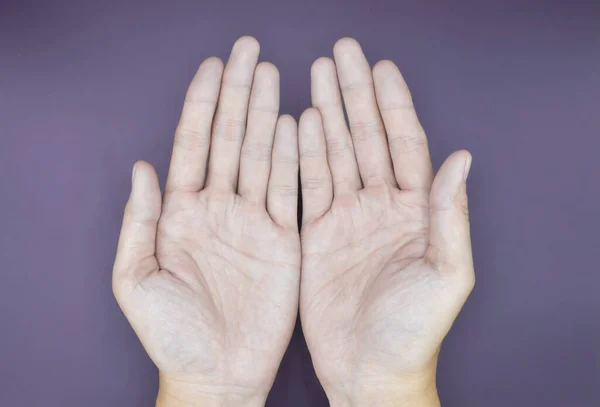 Superficie Palmar Pálida Ambas Manos Manos Anémicas Asiático Chino Aislado — Foto de Stock