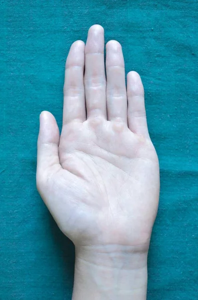 Бледная Ладонь Поверхности Руки Анемическая Рука Азиата Китайца — стоковое фото