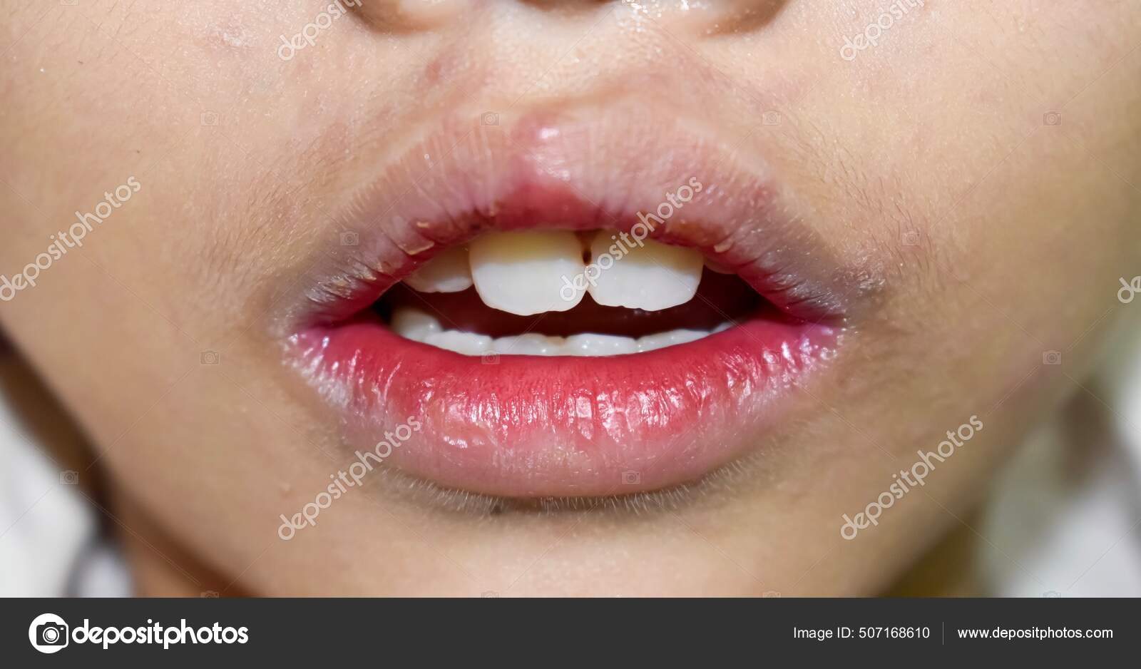 Riboflavin Stock Photos Royalty Free Riboflavin Images Depositphotos