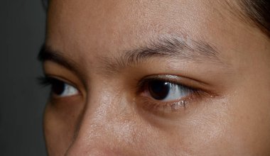 Yağlı yüzlü Asyalı genç kadının çift göz kapakları.