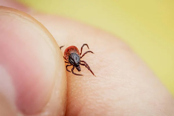 Sangue perigoso chupando carrapato rastejando na pele humana é pego pela mão. Besouro alergénico parasita — Fotografia de Stock