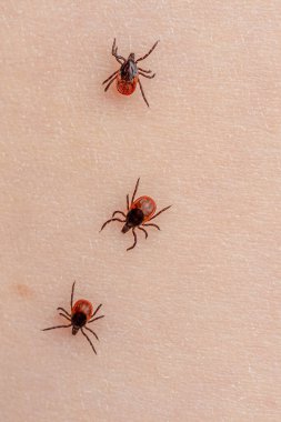 Parazit akarlardan oluşan bir grup insan derisinin üzerinde sürünüyor. Bulaşıcı kan emen böcekler insanlar için tehlikelidir. Açık arkaplanda küçük kahverengi böcekler