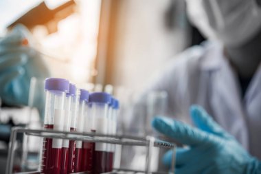 Laboratuvardaki test tüpündeki kan örneği. Tıbbi, farmasötik ve bilimsel araştırma ve geliştirme kavramı. 