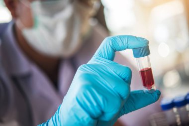 Laboratuvar teknisyeni laboratuvarda bir kan örneğini analiz ediyor. Tıbbi, farmasötik ve bilimsel araştırma ve geliştirme kavramı. 