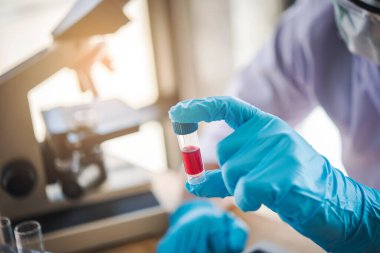 Laboratuvar teknisyeni laboratuvarda bir kan örneğini analiz ediyor. Tıbbi, farmasötik ve bilimsel araştırma ve geliştirme kavramı. 