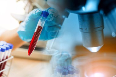 Laboratuvar teknisyeni laboratuvarda bir kan örneğini analiz ediyor. Tıbbi, farmasötik ve bilimsel araştırma ve geliştirme kavramı. 