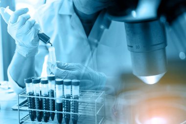 Laboratuvar teknisyeni laboratuvarda bir kan örneğini analiz ediyor. Tıbbi, farmasötik ve bilimsel araştırma ve geliştirme kavramı. 