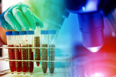 Laboratuvar teknisyeni laboratuvarda bir kan örneğini analiz ediyor. Tıbbi, farmasötik ve bilimsel araştırma ve geliştirme kavramı. 