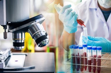 Laboratuvar teknisyeni laboratuvarda bir kan örneğini analiz ediyor. Tıbbi, farmasötik ve bilimsel araştırma ve geliştirme kavramı. 