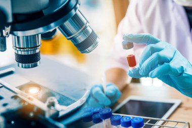Laboratuvar teknisyeni laboratuvarda bir kan örneğini analiz ediyor. Tıbbi, farmasötik ve bilimsel araştırma ve geliştirme kavramı. 