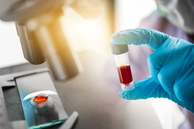 Laboratuvar teknisyeni mikroskopla test tüpündeki kan örneğini inceliyor. Tıbbi, farmasötik ve bilimsel araştırma ve geliştirme kavramı. 
