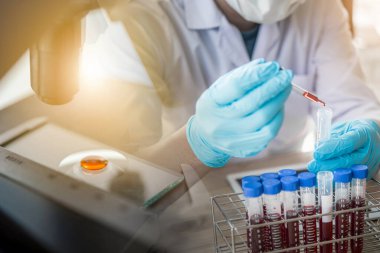 Laboratuvar teknisyeni mikroskopla test tüpündeki kan örneğini inceliyor. Tıbbi, farmasötik ve bilimsel araştırma ve geliştirme kavramı. 