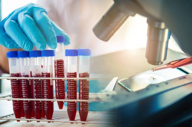 Laboratuvar teknisyeni mikroskopla test tüpündeki kan örneğini inceliyor. Tıbbi, farmasötik ve bilimsel araştırma ve geliştirme kavramı. 