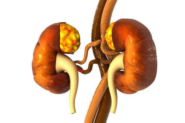 Human Kidney White Background Render — Stock Photo, Image